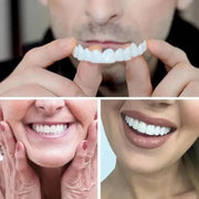 SMILEFIT PRO – PODESIVI SET PROTEZA ZA SAVRŠEN OSMIJEH